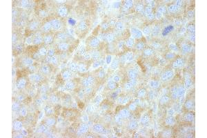 Immunohistochemistry (IHC) image for anti-Fatty Acid Synthase (FASN) (AA 2462-2511) antibody (ABIN7448964) (Fatty Acid Synthase 抗体  (AA 2462-2511))