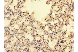 Immunohistochemistry of paraffin-embedded human lung tissue using ABIN7142435 at dilution of 1:100 (MRPL39 抗体  (AA 1-158))
