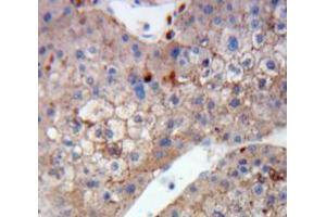 Used in DAB staining on fromalin fixed paraffin-embedded Liver tissue (DCT 抗体  (AA 28-263))