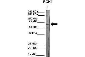 WB Suggested Anti-PCK1 Antibody    Positive Control:  Lane 1: 80ug pig serum protein   Primary Antibody Dilution :   1:1000  Secondary Antibody :  Anti-rabbit-HRP   Secondry Antibody Dilution :   1:500  Submitted by:  Martina Ondrovics, University of Veterinary Medicine Vienna (PCK1 抗体  (Middle Region))