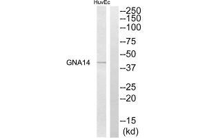 Western blot analysis of extracts from HuvEc cells, using GNA14 antibody. (GNa14 抗体  (N-Term))