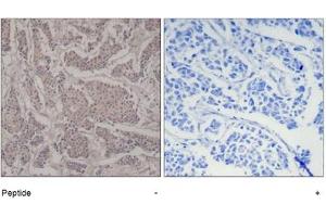 Image no. 1 for anti-SMAD, Mothers Against DPP Homolog 3 (SMAD3) (Ser425) antibody (ABIN319359)