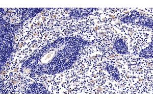 Immunohistochemistry (IHC) image for anti-CD40 Ligand (CD40LG) (AA 180-261) antibody (ABIN7431101)