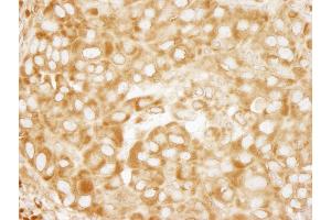 Immunohistochemistry (IHC) image for anti-Ribosomal Protein L7 (RPL7) (C-Term) antibody (ABIN7449014)