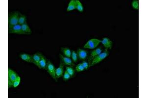 Immunofluorescent analysis of HepG2 cells using ABIN7151428 at dilution of 1:100 and Alexa Fluor 488-congugated AffiniPure Goat Anti-Rabbit IgG(H+L) (EFHD2 抗体  (AA 2-240))