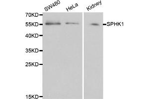Western blot analysis of extracts of various cell lines, using SPHK1 antibody. (SPHK1 抗体)
