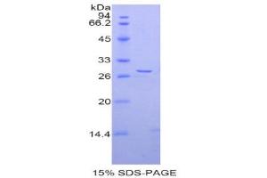 SDS-PAGE (SDS) image for A Disintegrin and Metallopeptidase Domain 5 (ADAM5) (AA 413-649) protein (His tag) (ABIN1877554)