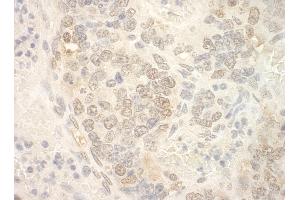 Immunohistochemistry (IHC) image for anti-Nuclear Cap Binding Protein Subunit 2 (NCBP2) (AA 106-156) antibody (ABIN7448682) (NCBP2 抗体  (AA 106-156))