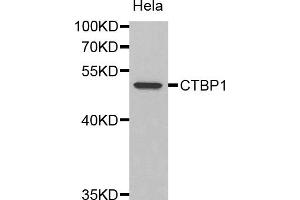 Western blot analysis of extracts of HeLa cells, using CTBP1 antibody (ABIN1872058).