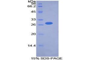 SDS-PAGE analysis of Mouse PDK2 Protein. (PDK2 蛋白)