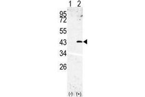 Western blot analysis of SPPL3(arrow) using rabbit polyclonal SPPL3 Antibody