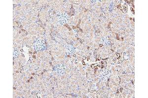 IHC analysis of GUSB using anti-GUSB antibody (ABIN7599854).
