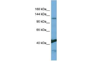 Host:  Rabbit  Target Name:  NINL  Sample Type:  Hela Whole Cell lysates  Antibody Dilution:  1. (NINL 抗体  (Middle Region))