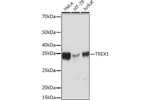 Western blot analysis of extracts of various cell lines, using TREX1 Rabbit mAb (ABIN7270814) at 1:1000 dilution. (TREX1 抗体)