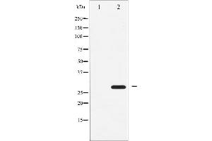 Western blot analysis of ATF1 expression in COLO205 whole cell lysates,The lane on the left is treated with the antigen-specific peptide. (AFT1 抗体  (Internal Region))