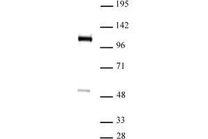 FOXM1 antibody (pAb) tested by Western blot. (FOXM1 抗体  (C-Term))