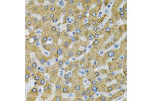 Immunohistochemistry of paraffin-embedded human liver injury using SDC4 Antibody (ABIN5970935) at dilution of 1/100 (40x lens). (SDC4 抗体)