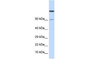 Western Blot showing ZNF251 antibody used at a concentration of 1-2 ug/ml to detect its target protein. (ZNF251 抗体  (Middle Region))