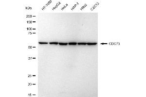 Western blotting analysis using CDC73 antibody (ABIN7799734). (Recombinant HRPT2 抗体)