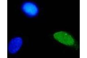 Immunofluorescence (IF) image for anti-Human Papilloma Virus Type 11 (HPV-11) (AA 83-201) antibody (ABIN781774) (人 Papilloma Virus Type 11 (HPV-11) (AA 83-201) 抗体)