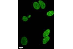 Immunofluorescence staining of Hela cells withABIN7127303 at 1:96,counter-stained with DAPI. (Recombinant HIST1H3A 抗体  (H3R17me))