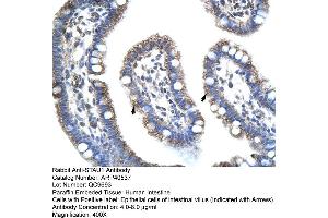 Rabbit Anti-STAU1 Antibody  Paraffin Embedded Tissue: Human Intestine Cellular Data: Epithelial cells of intestinal villas Antibody Concentration: 4. (STAU1/Staufen 抗体  (N-Term))