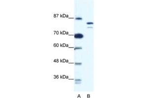 Western Blotting (WB) image for anti-Minichromosome Maintenance Deficient 8 (MCM8) antibody (ABIN2461402) (MCM8 抗体)