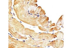 Immunohistochemistry (IHC) image for anti-SMAD, Mothers Against DPP Homolog 1 (SMAD1) (AA 163-196) antibody (ABIN3032610)