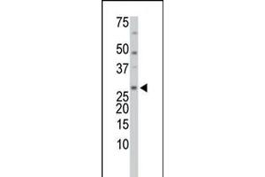 Antibody is used in Western blot to detect TrxL in HL-60 cell lysate. (TXNL1 抗体  (C-Term, Trp32))