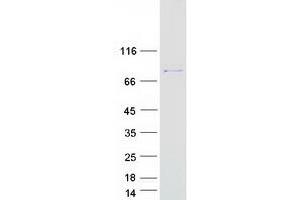 Western Blotting (WB) image for Diacylglycerol Kinase, alpha 80kDa (DGKA) (Transcript Variant 2) protein (Myc-DYKDDDDK Tag) (ABIN2712275)