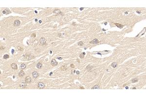 Immunohistochemistry (IHC) image for anti-GDNF Family Receptor alpha 1 (GFRA1) (AA 239-350) antibody (ABIN7430060)