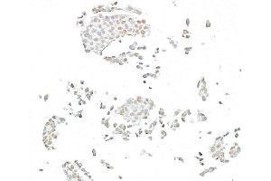 Immunocytochemistry (ICC) image for anti-BRCA1 Associated Protein-1 (Ubiquitin Carboxy-terminal Hydrolase) (BAP1) (AA 475-525) antibody (ABIN7795817)
