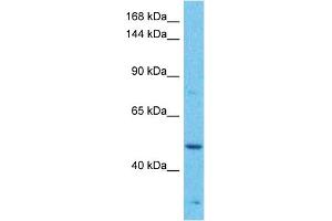 Host:  Rabbit  Target Name:  MAP3K1  Sample Tissue:  Human Jurkat Whole Cell  Antibody Dilution:  1ug/ml (MAP3K1 抗体  (C-Term))