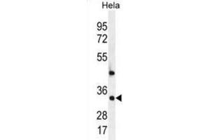 Western Blotting (WB) image for anti-Mediator Complex Subunit 7 (MED7) antibody (ABIN2996463) (MED7 抗体)
