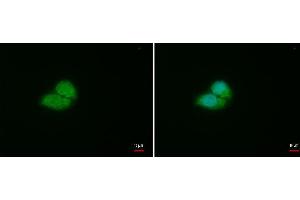 Immunofluorescence (IF) image for anti-Von Hippel-Lindau Tumor Suppressor, E3 Ubiquitin Protein Ligase (VHL) antibody (ABIN2854928)