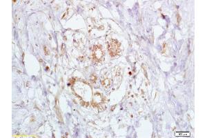 Immunohistochemistry (IHC) image for anti-Breast Cancer 2, Early Onset (BRCA2) (AA 21-130) antibody (ABIN673434)