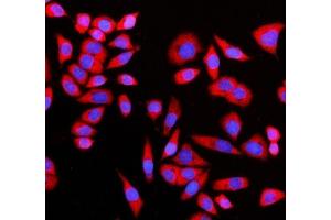 IF analysis of GIGYF2 using anti-GIGYF2 antibody (ABIN7601679). (GIGYF2 抗体  (AA 413-1299))