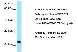 Western Blotting (WB) image for anti-Killer Cell Lectin-Like Receptor Subfamily K, Member 1 (KLRK1) (C-Term) antibody (ABIN2789432) (KLRK1 抗体  (C-Term))