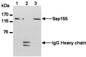 Western Blotting (WB) image for anti-Splicing Factor 3b, Subunit 1, 155kDa (SF3B1) (AA 98-198) antibody (ABIN1449241) (SF3B1 抗体  (AA 98-198))