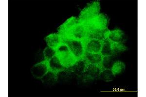Immunofluorescence of monoclonal antibody to FNDC3A on A-431 cell.