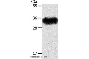 Western blot analysis of Mouse brain tissue, using STX1A Polyclonal Antibody at dilution of 1:600 (STX1A 抗体)