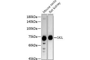 Western blot analysis of extracts of various cell lines, using SKIL antibody (ABIN6130691, ABIN6147811, ABIN6147812 and ABIN6221543) at 1:1000 dilution.