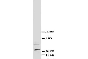 Anti-NGF antibody, Western blotting WB: Rat Brain Tissue Lysate (Nerve Growth Factor 抗体  (N-Term))
