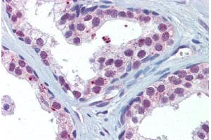 Prostate, Human: Formalin-Fixed, Paraffin-Embedded (FFPE) (AKT1/2 抗体)