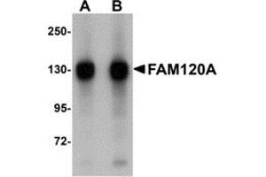 Western Blotting (WB) image for anti-Family with Sequence Similarity 120A (FAM120A) (Middle Region) antibody (ABIN1030930)