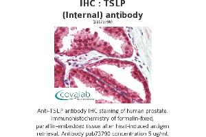 Image no. 3 for anti-Thymic Stromal Lymphopoietin (TSLP) (Internal Region) antibody (ABIN1740422) (Thymic Stromal Lymphopoietin 抗体  (Internal Region))