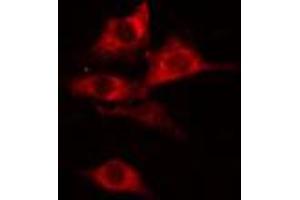 ABIN6274775 staining COLO205 cells by IF/ICC. (RPL27A 抗体  (C-Term))