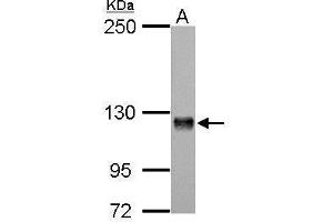 WB Image Amphiphysin antibody [N1N2], N-term detects AMPH protein by Western blot analysis. (Amphiphysin 抗体  (N-Term))