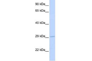 WB Suggested Anti-SLC25A6 Antibody Titration: 0. (SLC25A6 抗体  (N-Term))
