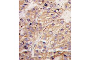 Immunohistochemistry (Paraffin-embedded Sections) (IHC (p)) image for anti-SMAD Specific E3 Ubiquitin Protein Ligase 1 (SMURF1) (AA 66-96), (N-Term) antibody (ABIN388828)